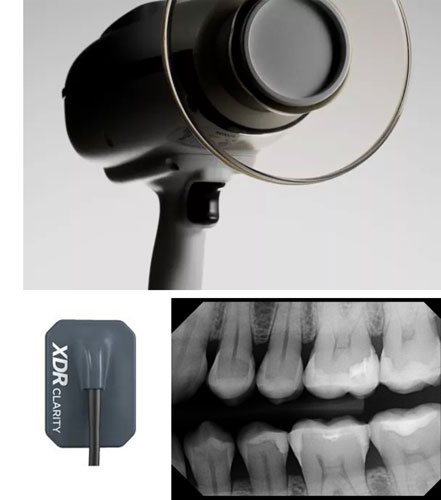 NOMAD and XDR Digital X-Rays