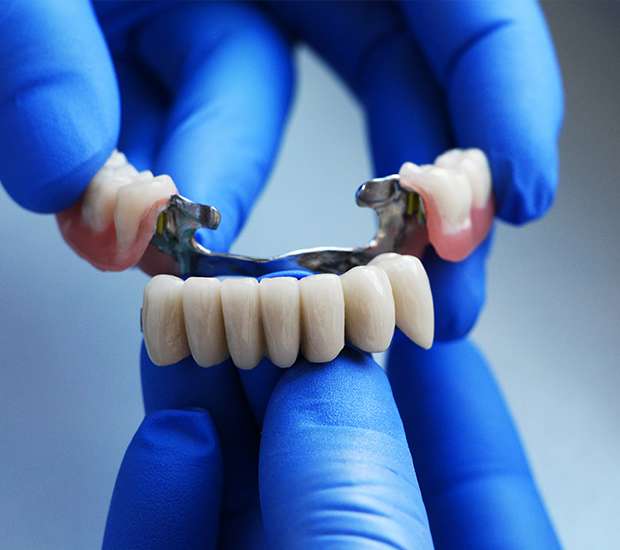 Bryan Dental Bridges