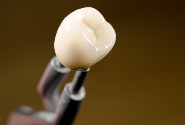 The Dental Crown Process: Repairing Teeth