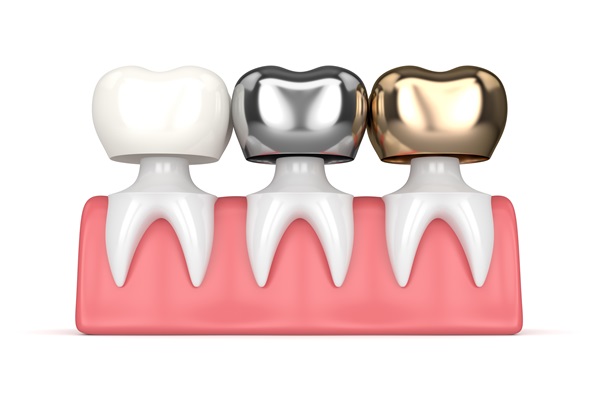 Foods To Avoid With Dental Crowns