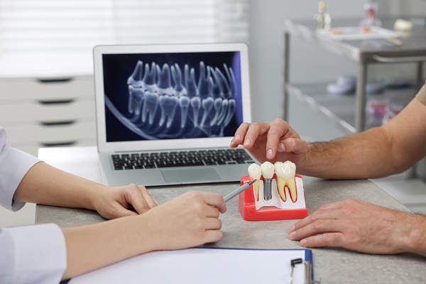 A Step By Step Guide To Getting A Dental Crown