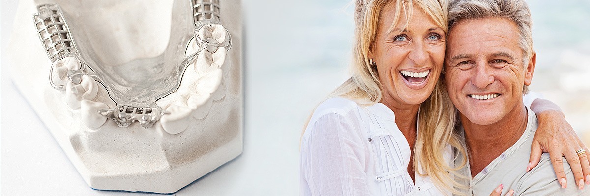 Bryan Dental Crowns