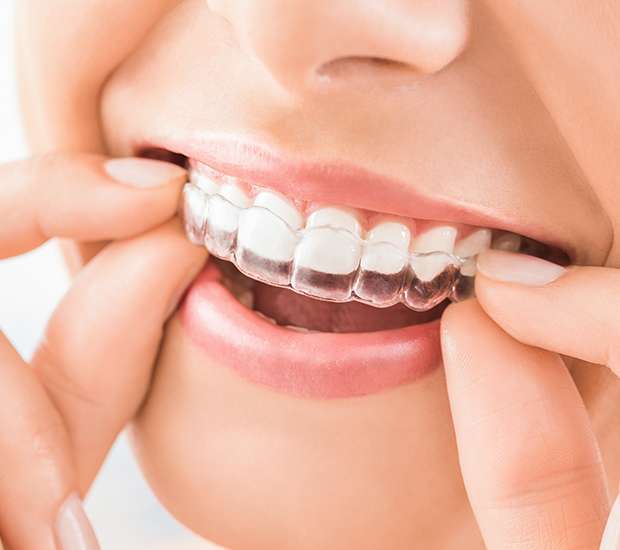 Bryan Does Invisalign® Really Work?