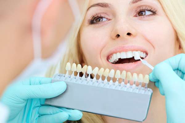 How a Cosmetic Dentist Places Dental Veneers from Rivers Family Dentistry in Bryan, TX