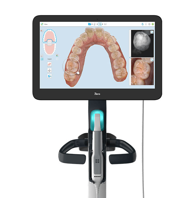 iTero 3D digital imaging