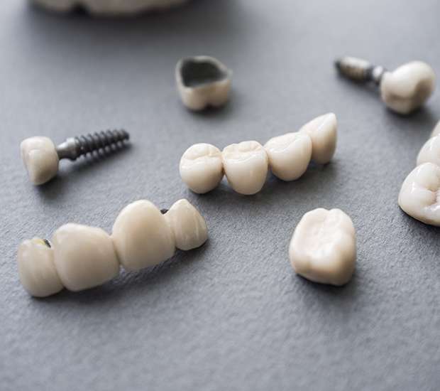 Bryan The Difference Between Dental Implants and Mini Dental Implants
