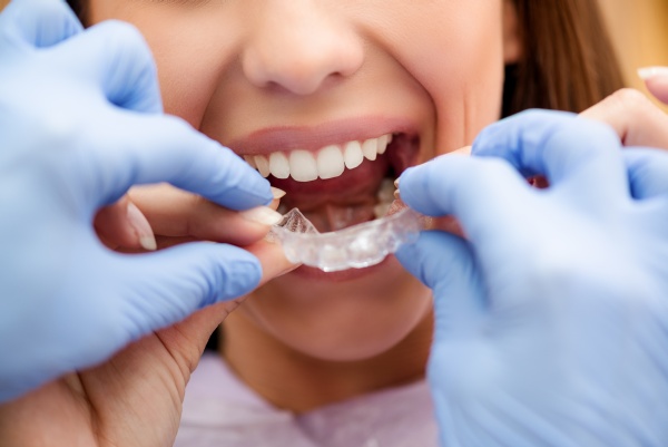 Preventing Yellow Teeth With Invisalign®