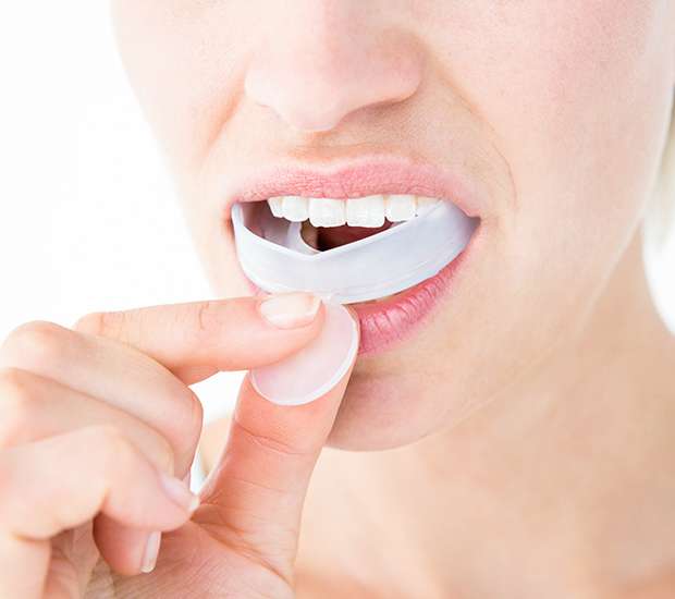 Bryan Mouth Guards