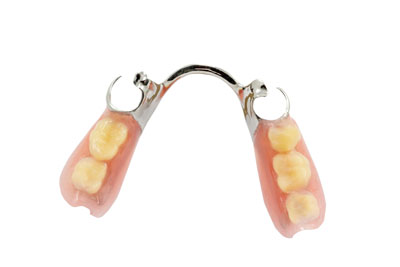 Partial Denture Treatment