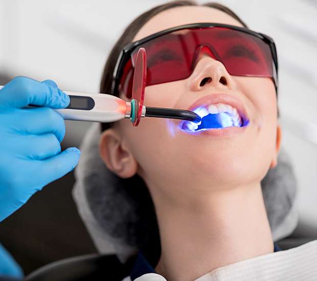 Bryan Professional Teeth Whitening