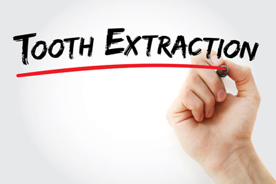 What To Expect From Wisdom Teeth Removal In Bryan